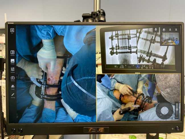 asl vercelli operazione streaming