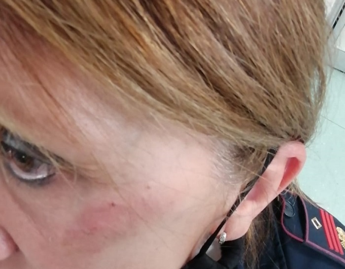 Vercelli, libera la donna che ha aggredito la poliziotta, l’agente parte civile